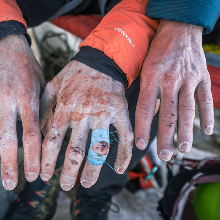 BD athlete Babsi Zangerl's and BD Ambassador Jacopo Larcher's hands after climbing a big wall. 